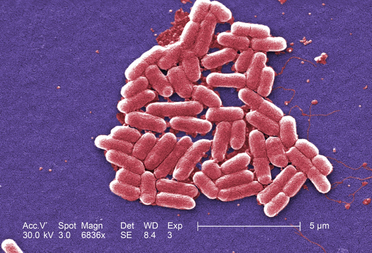 H7-number-Escherichia-coli-bacteria-O157.jpg
