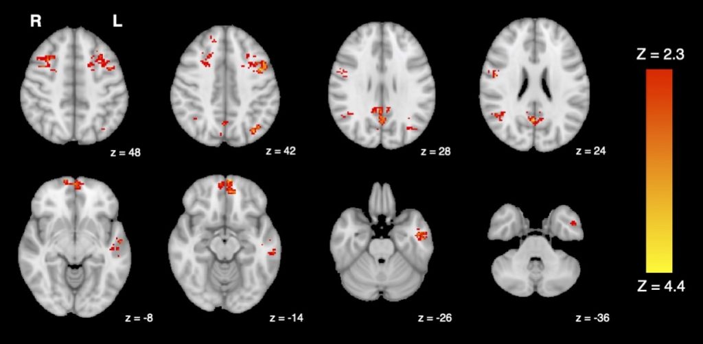 main-image-fmri-shows-decreased-functional-connectivity-after-exposure-to-car-exhaust-1024x502.jpg