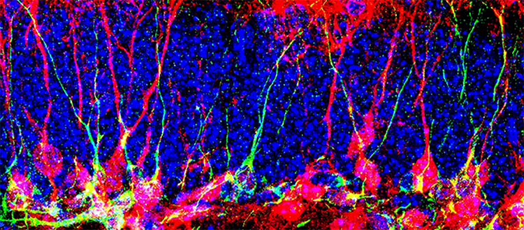 image-20230228113322-1.png