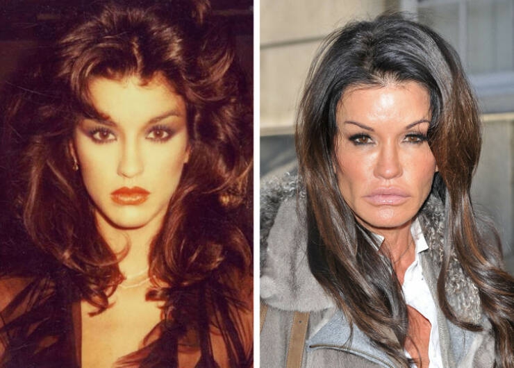 before_and_after_celebrity_makeovers_through_plastic_surgery_640_01.jpg