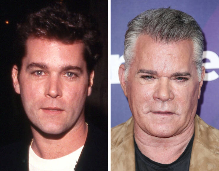 before_and_after_celebrity_makeovers_through_plastic_surgery_640_02.jpg