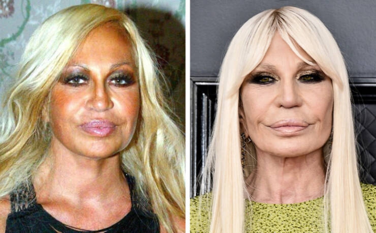before_and_after_celebrity_makeovers_through_plastic_surgery_640_04.jpg