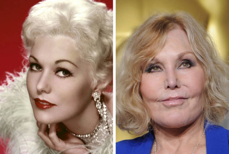 before_and_after_celebrity_makeovers_through_plastic_surgery_640_05.jpg