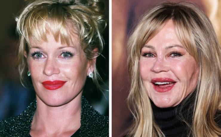 before_and_after_celebrity_makeovers_through_plastic_surgery_640_07.jpg