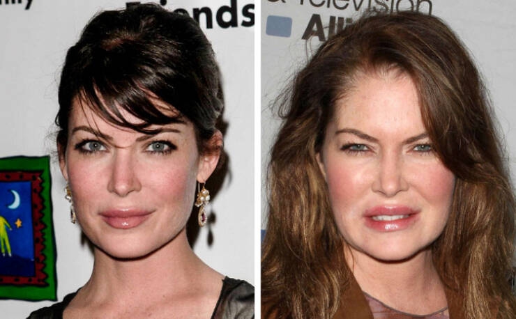 before_and_after_celebrity_makeovers_through_plastic_surgery_640_08.jpg