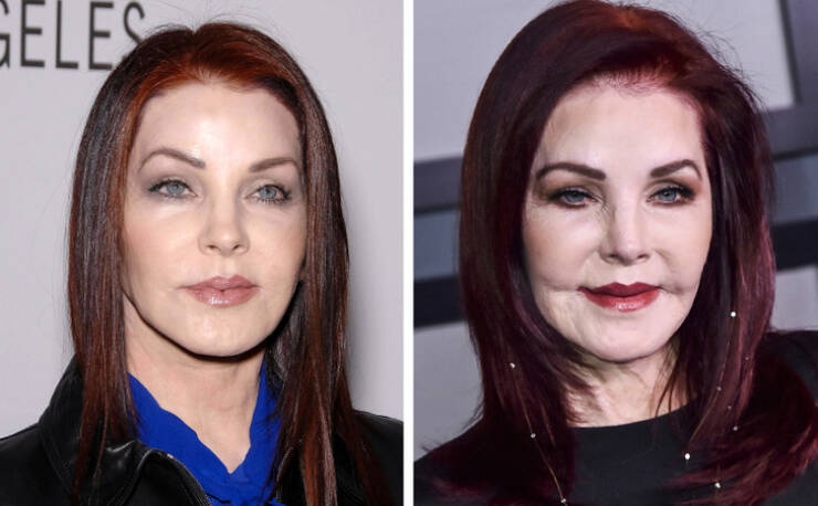 before_and_after_celebrity_makeovers_through_plastic_surgery_640_09.jpg
