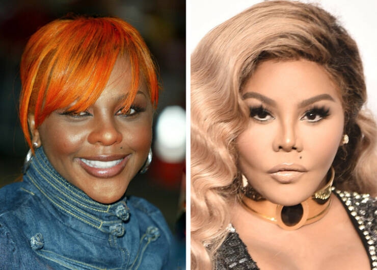 before_and_after_celebrity_makeovers_through_plastic_surgery_640_10.jpg