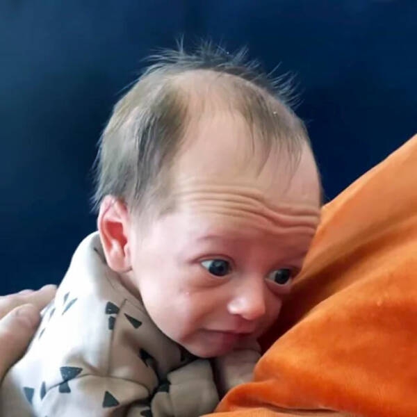 beyond_their_years_benjamin_button_babies_defying_age_norms_640_12.jpg